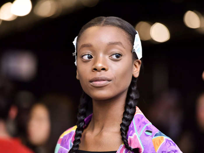 Model Olivia Anakwe made headlines after revealing the struggles she experienced at photoshoots and projects.