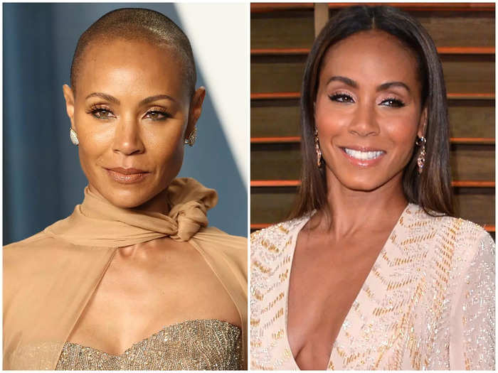 Jada Pinkett Smith has spoken about her hair journey and her struggles with alopecia, which led to shaving her head.