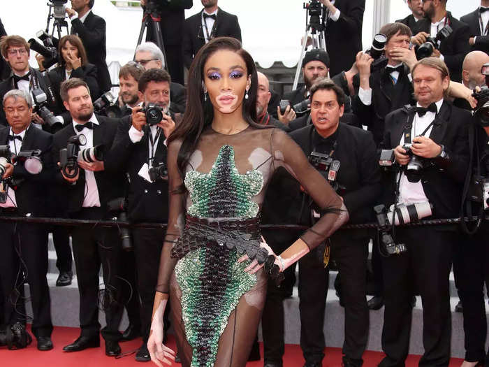 Winnie Harlow