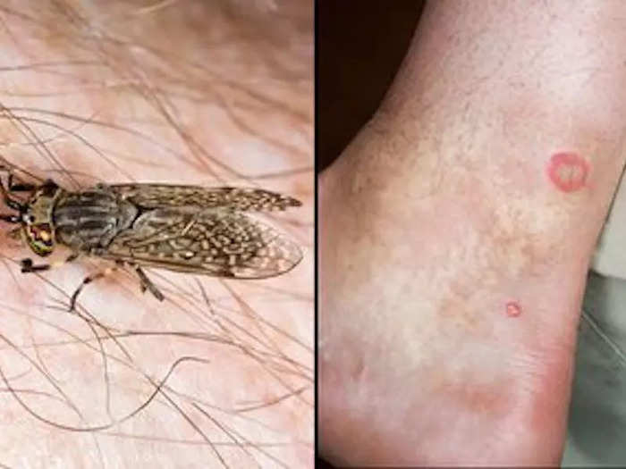 Horsefly bites are painful and potentially dangerous.