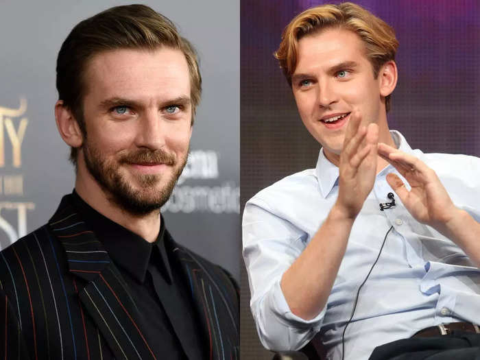 Dan Stevens dropped 30 pounds after leaving "Downton Abbey."