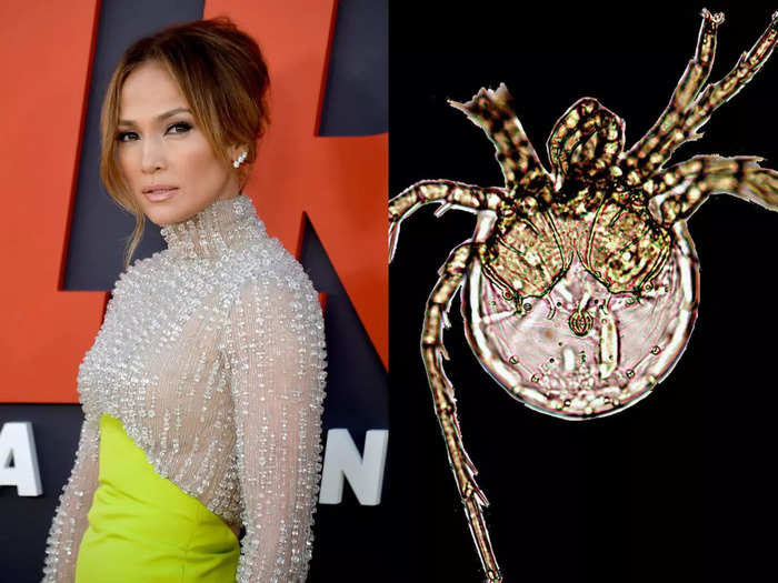 Jennifer Lopez and the Litarachna lopezae mite