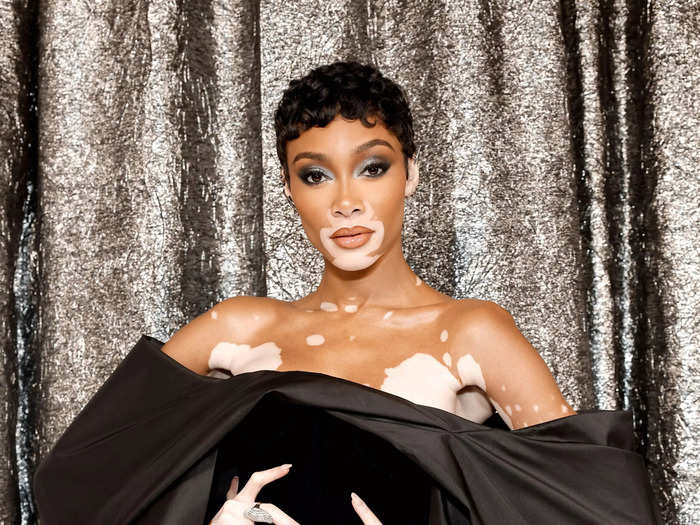 Model Winnie Harlow added some pizzazz with these voluminous sleeves.