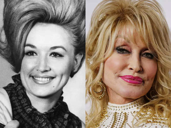 While in her 20s, Dolly Parton released some of her biggest hits.