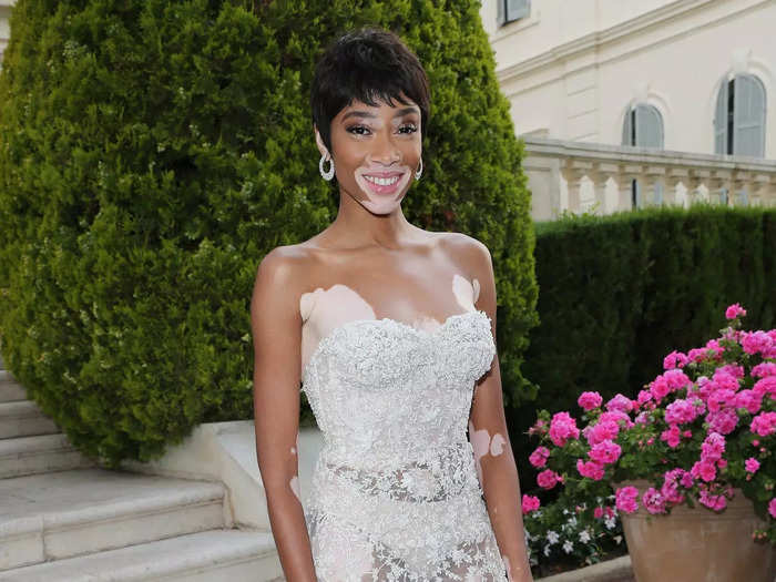 Winnie Harlow also rocked the "naked" trend that year.