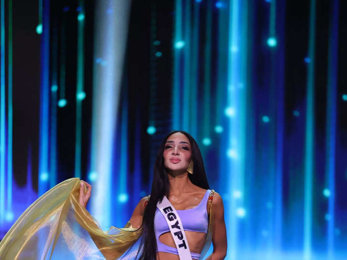 Miss Egypt Logina Salah was the first woman with vitiligo to compete in the pageant. 