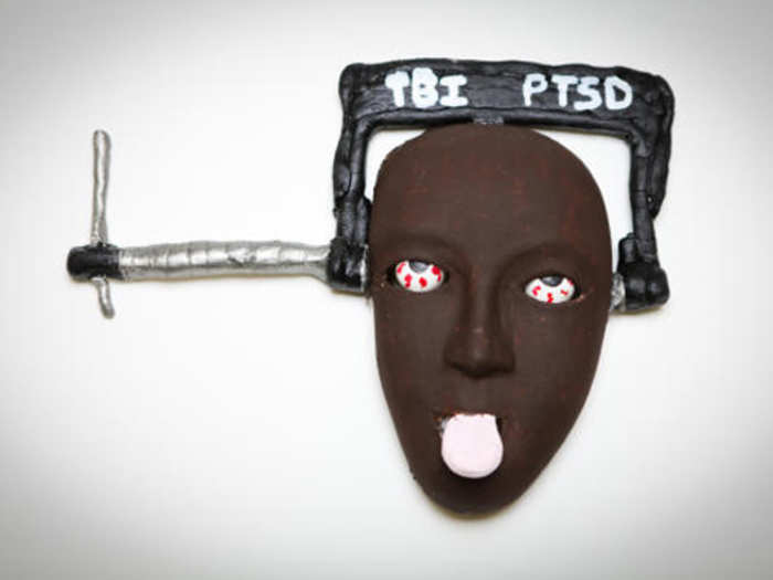 The soldier who created this mask is suffering from a traumatic brain injury (TBI) and post-traumatic stress disorder (PTSD). The constant pressure of a vice symbolizes the pain he feels as a result of his injuries.