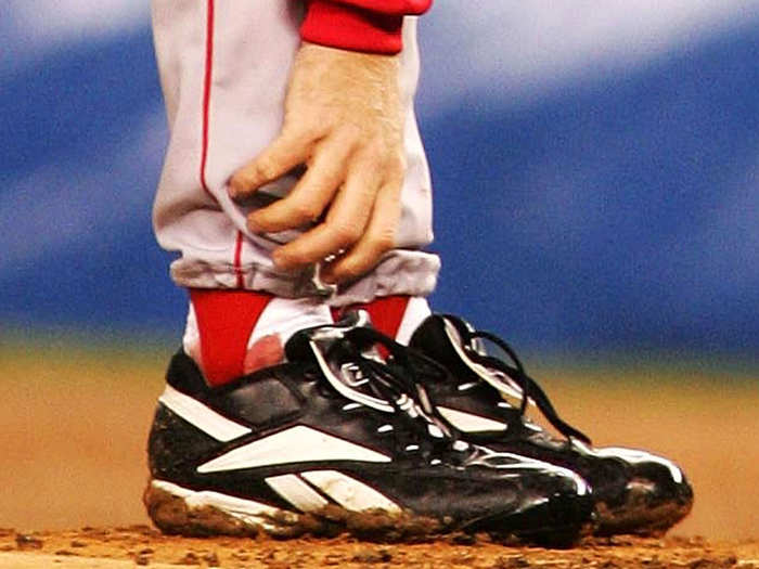 Curt Schilling won Game 6 of the 2004 ALCS on a bloody ankle. Before the game, he had a crude surgery where a tendon in his ankle was sutured to his ankle tissue