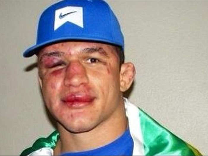 Junior Dos Santos after fighting Cain Velasquez