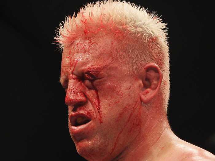 Chris Tuchscherer after fighting Mark Hunt