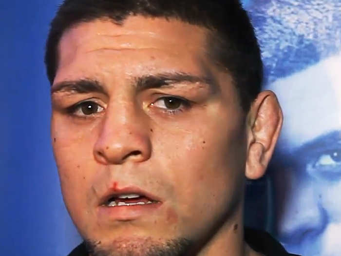 Nick Diaz