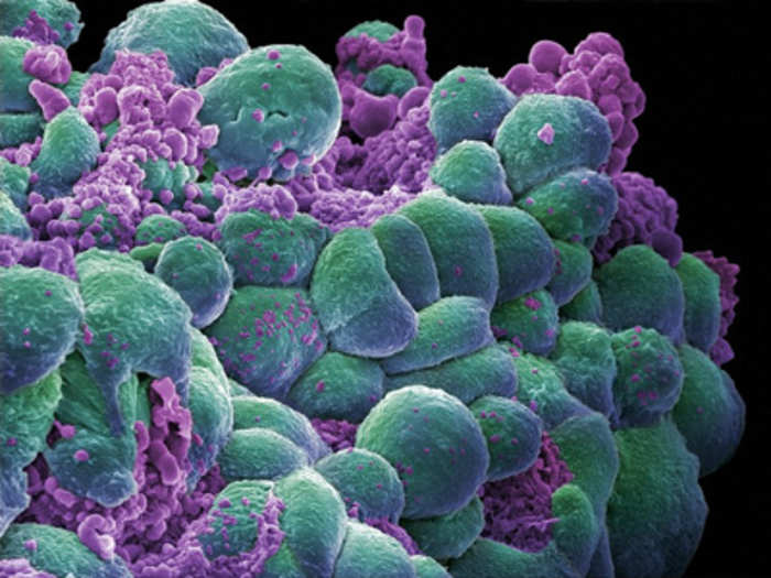 Fasting could help fight cancer.