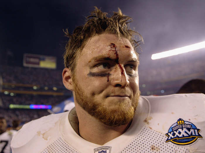 Raiders fullback Jon Ritchie after losing to the Bucs