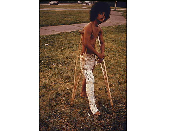 Young man with his leg in a cast in Highland Park.