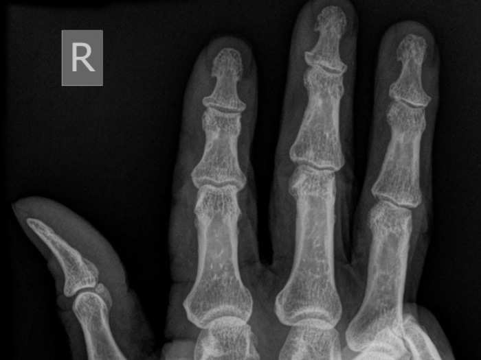 X-ray vision may come to your smartphone