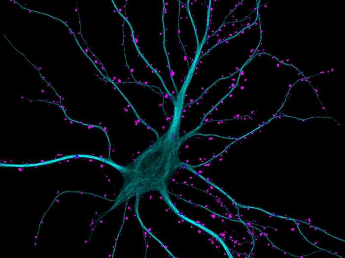 Dr. Kieran Boyle of the University of Glasgow, in Scotland took this image of a brain cell in the hippocampus, receiving excitatory contacts. It is enlarged 63 times.