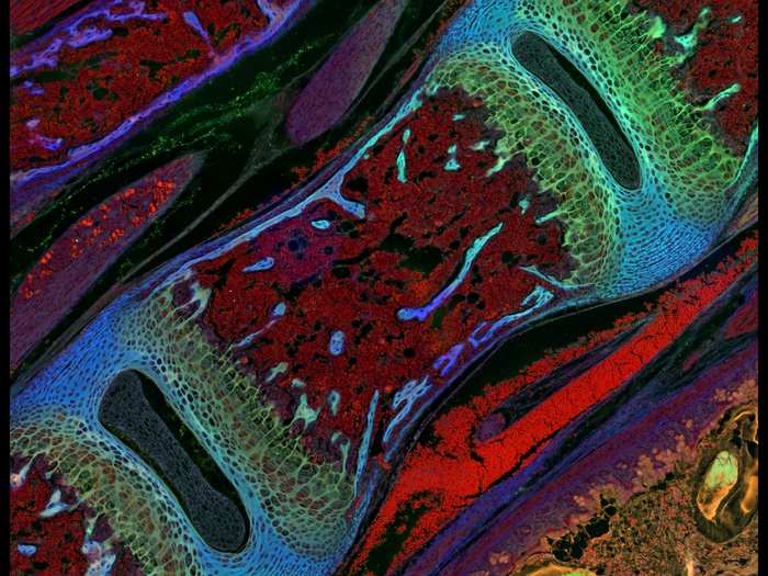 Dr. Michael Paul Nelson and Samantha Smith, of the University of Alabama at Birmingham, took this image of a section of the vertebra of a mouse, magnified 200 times.