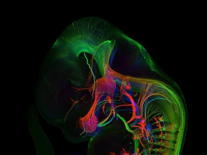 Mr. Zhong Hua, of Johns Hopkins University School of Medicine, took this image of the peripheral nerves (those outside of the brain) in an 11.5-day-old mouse embryo, magnified five times.