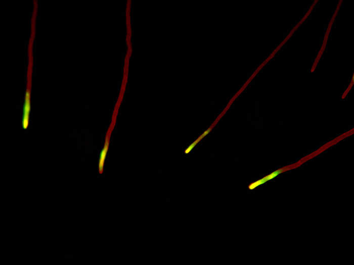 Dr. Christian Q. Scheckhuber, of Goethe University in Germany. took this image of the "filamentous tip cells" in the fungus Podospora anserina. The image was magnified 630 times.