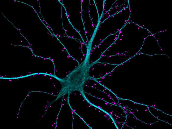 Dr. Kieran Boyle of the University of Glasgow in Scotland took this image of a brain cell in the hippocampus as it received excitatory contacts. It was a finalist in Nikon