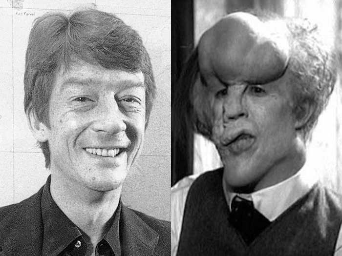 John Hurt wore prosthetics to channel a deformed Joseph Merrick in "The Elephant Man."