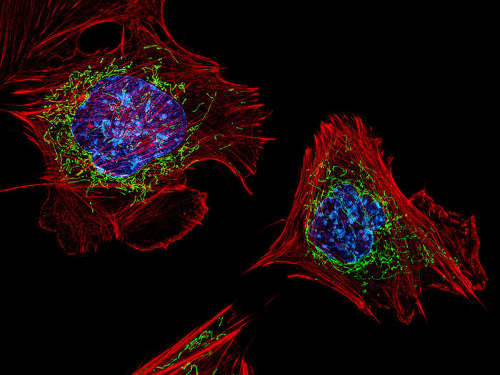 Dylan Burnette from the National Institutes of Health took fifth prize for an image of mouse embryonic fibroblasts stained to show the active filaments in red and DNA in blue. The image also shows the insides of mitochondria, the cells