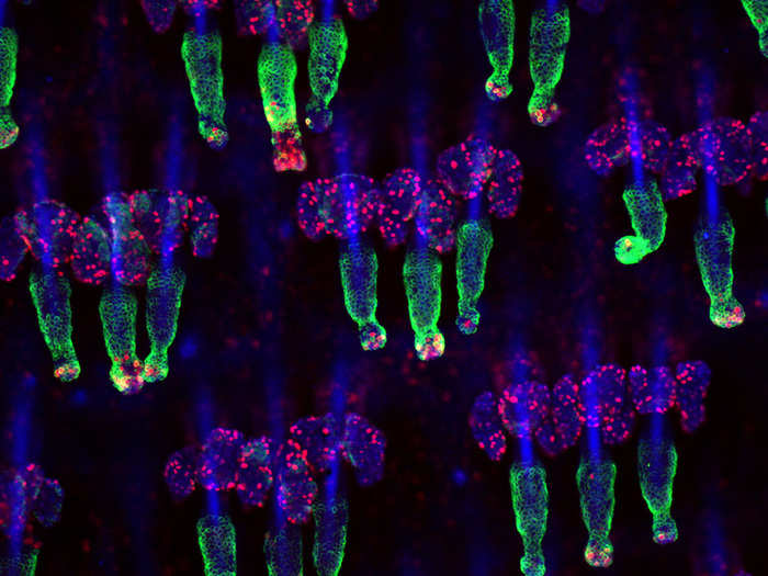 Yaron Fuchs got eighth prize for this stained image of mouse tails. K15, the hair follicle stem cell marker, is green, and Ki67, which marks proliferating cells, is red. Nuclei are marked in blue.