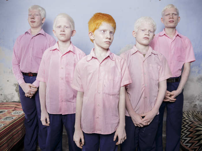 At the Vivekananda Mission School in West Bengal, India, a group of blind albino boys stand for a portrait. The school is one of the few schools for the blind in India.