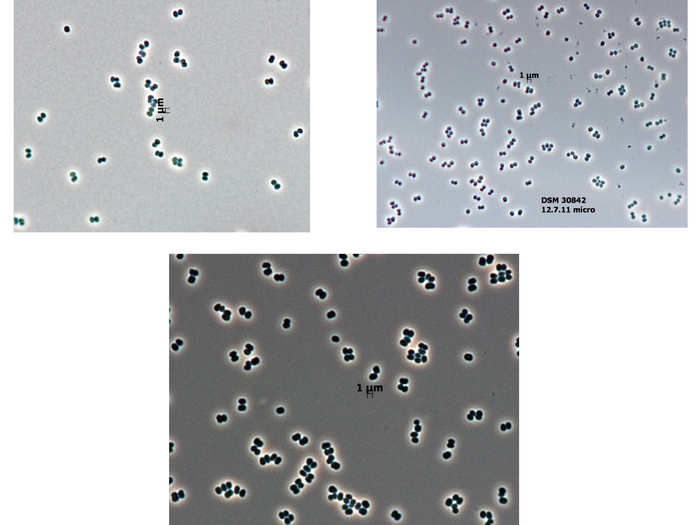 Clean room microbes have only ever been found in one ecosystem — the rooms where spacecraft are assembled. They were found in both a Florida and a French Guiana clean room, even after sterilization. Scientists worry they could contaminate other planets.