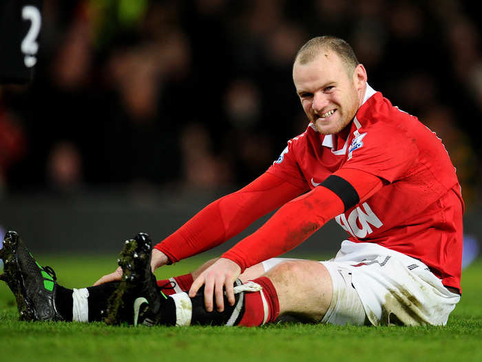 Rooney was open about getting a hair transplant in 2011 when he started going bald at the age of 25.