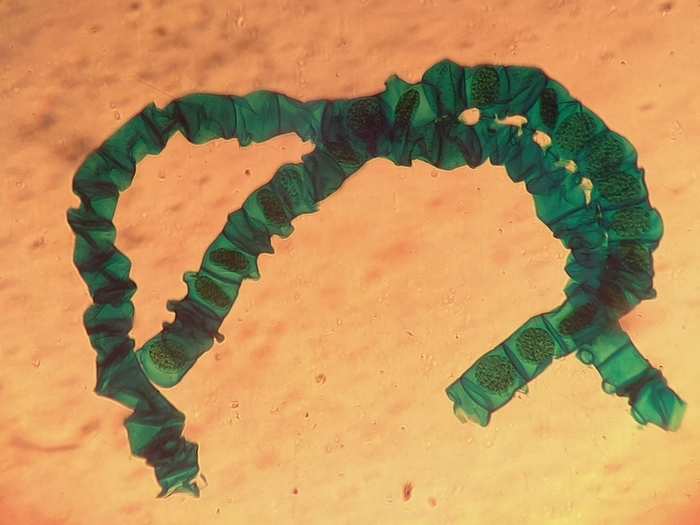 Mike Cook on his microscopic photo: "Ever seen two plants having sex? The Spirogyia does. Here are two exchanging packets of cells. Note it is a s