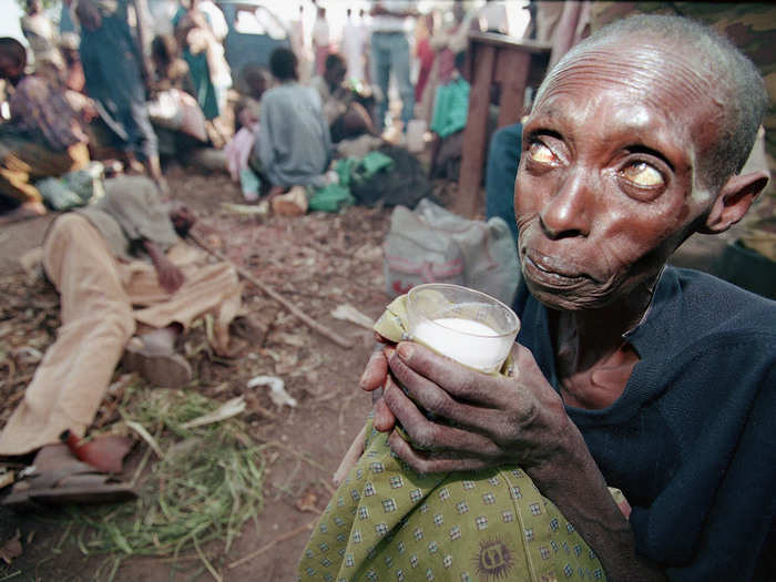 This photo taken by Jean-Marc Bouju in 1994, shows a starving woman at a makeshift health clinic in Ruhango, Rwanda, where thousands of civilians took refuge from the fighting between government troops and the Rwandan rebels. With no access to sufficient medical care, doctors said 20 to 25 people in Rwanda died every day from disease and hunger during the fighting. This photo, part of a larger portfolio, won the Associated Press the Pulitzer Prize for Feature Photography.