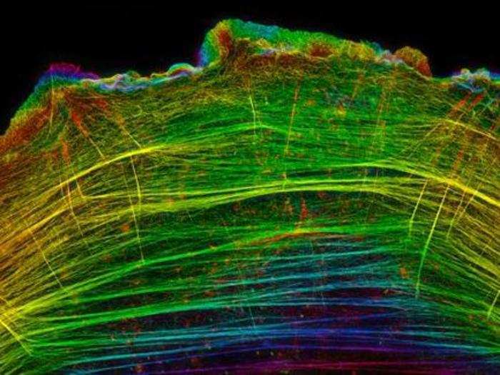 Dylan T. Burnette of Nashville, Tenn. took this photo of a rainbow-colored crawling bone cancer cell. Protein filament bundles streak the inside of the cell, which has been magnified 8,000 times.