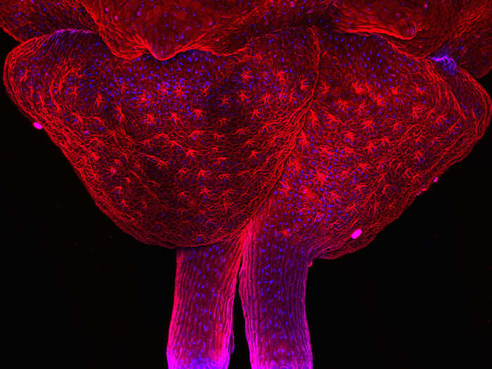 This image of a parsley ovary was taken by Meritxell Venrell of Spain and has been stained to show its nuclei, the command centers of the cell, in blue and its lectin proteins in red. It has been magnified 63 times.