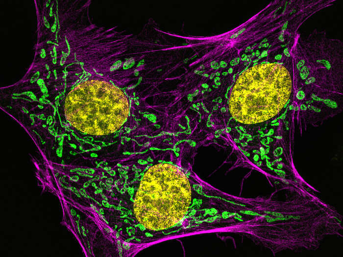 Muthugapatti Kandasamy of Georgia snapped this image of the endothelial cells that line the inside of a cow’s lung artery. The cells are stained pink for the protein actin, green for mitochondria (the cell’s energy powerhouses), and yellow for DNA. Since it was taken using super resolution microscopy, this image was not magnified.