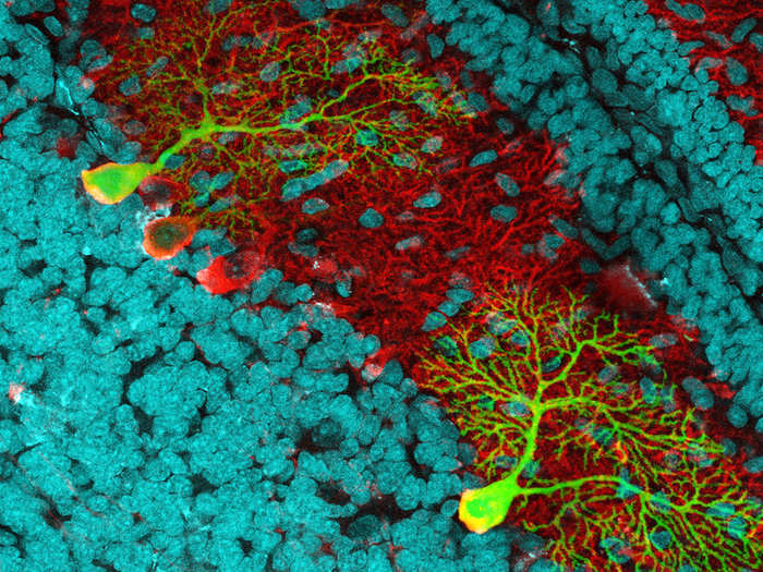 Honorable Mention: These cells live in the base of your brain. German Marco Dal Maschio snapped this shot of the transverse section of the brain showing its cell nuclei in turquoise. The deep red cells are Purkinje cells, some of the largest neurons in the brain. This image has been blown up 40 times.