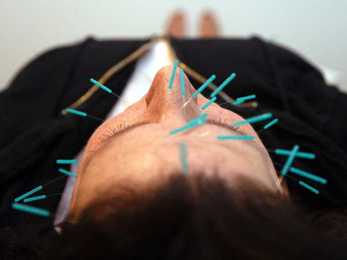 8. Acupuncturist