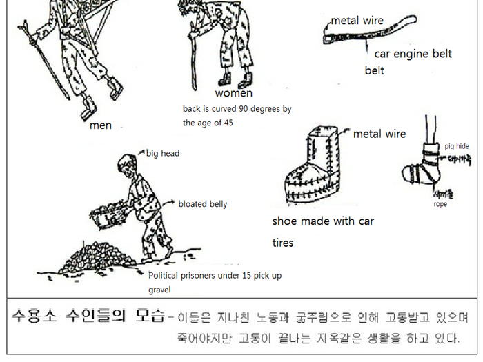 Without protein and calcium in their diet prisoners develop hunchbacks from bending over during forced labor in the fields or lose toes and fingers due to frostbite.