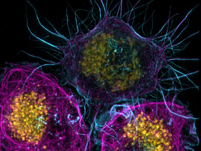 The fruit fly is a popular subject when it comes to studying genetics because they share 75% of the genes that cause disease in humans. Here is an image, captured by William Voss, of a type of fruit fly cell called S2.