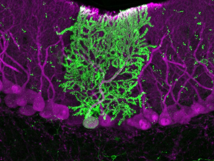 W. Todd Farmer magnified a portion of the mouse cerebellar cortex, a part of the brain, by 20 times to produce this image. In the middle in green you see what is called a Purkinje neuron, which is in the midst of other, unlabeled neurons.