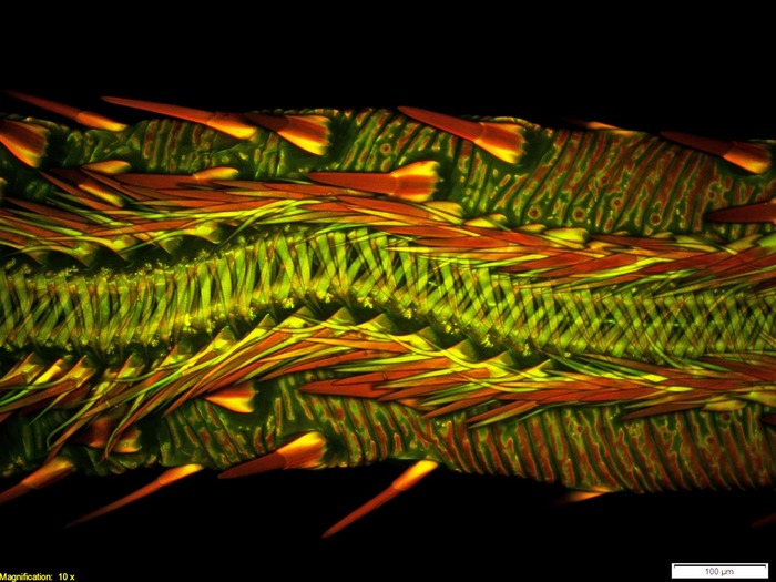 What would you guess this is? Probably not the mouth parts of what is known as a vampire moth. These moths feed on fruits and mammal blood. Matthew S. Lehnert and Ashley L. Lash clearly show, at 10 times magnification, the hooks and barbs that tear and cut fruit and mammal flesh alike.  Lehnert and Lash came in eighth place for this creepy and equally stunning image.