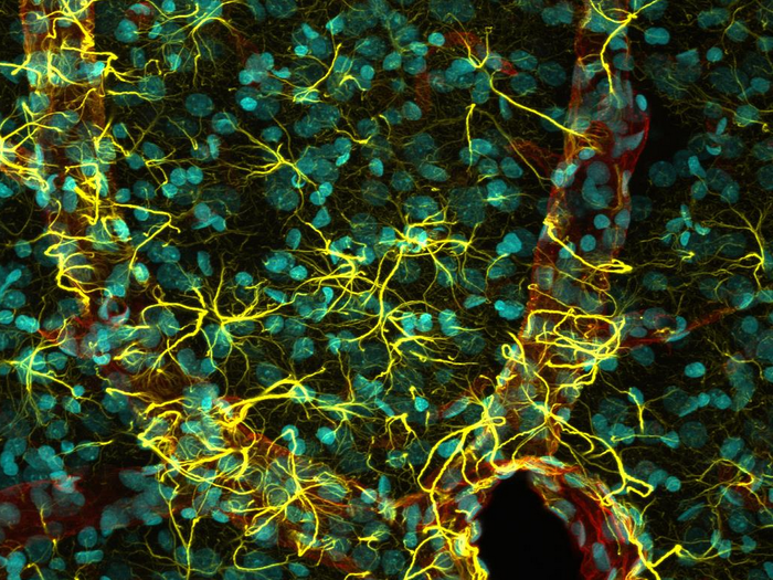 This intricate image includes cell nuclei, astrocytes (cells of the central nervous system), and blood vessels within the brain of a mouse. You have to hand it to Madelyn May for turning a complex system into such a beautiful image, which was awarded fifth place.