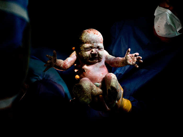 This project, called "Caesar," shows children born by cesarean section.