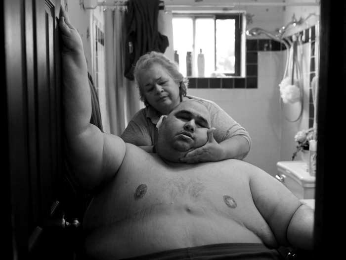 Hector Garcia Jr. of San Antonio, Texas is nearly 600 pounds. He struggles to complete daily tasks like bathing. When this photo was taken, Garcia had just begun dieting.