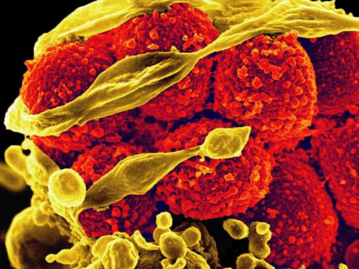 Bacteria have evolved to outsmart our antibiotics — and we’re on the cusp of an “apocalyptic scenario."