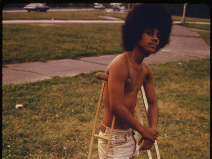 Young man with his leg in a cast in Highland Park