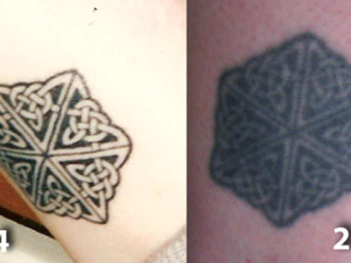 When tattoos age, often the ink begins to spread a bit, blurring previously sharp lines. This is an example of the before and after of a 15-year-old old tattoo.