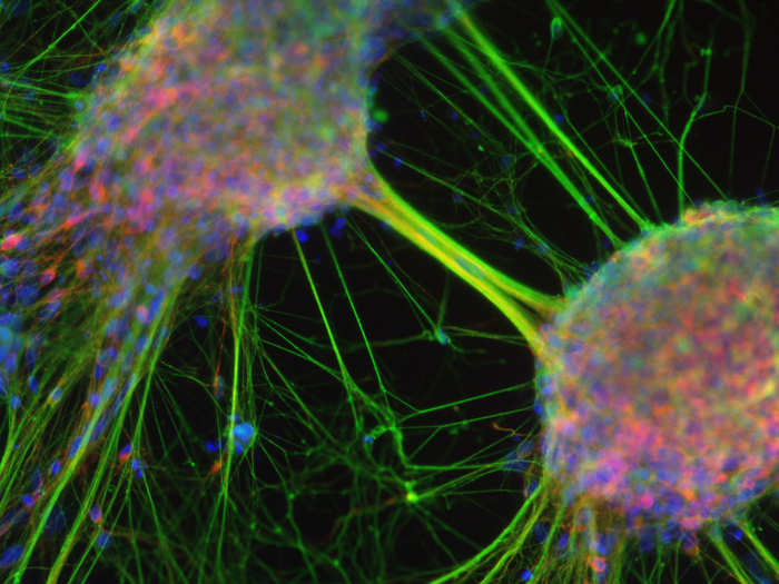 Human stem cells that have morphed into neurons