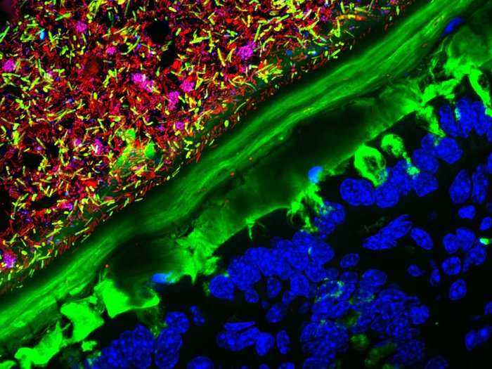 Mouse colon colonized with microbes from inside a human