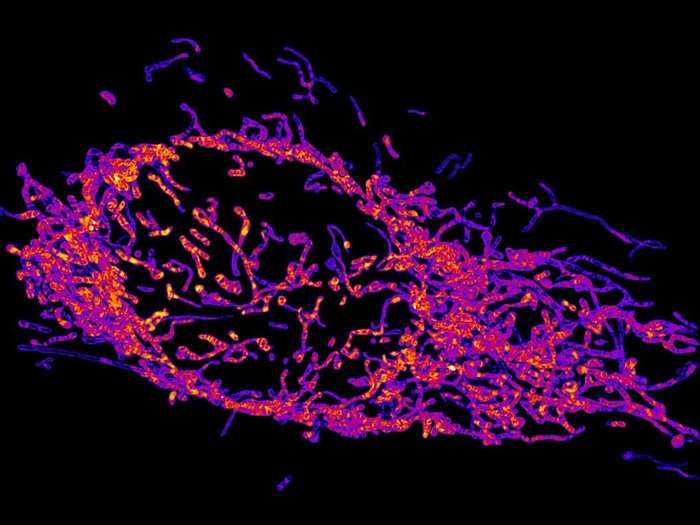 Mitochondria in a live cancer cell